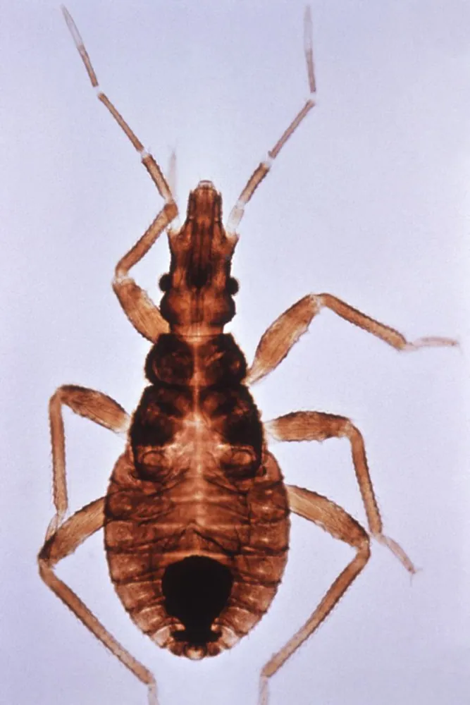 عکس Vinchuca kissing bug